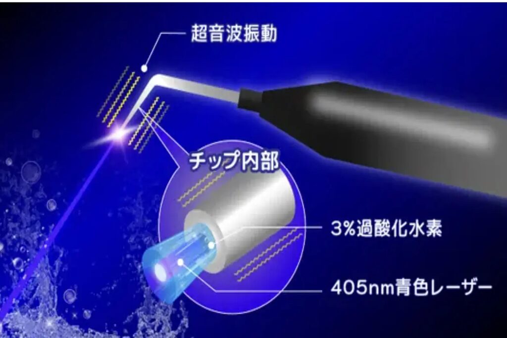 ブルーラジカル歯周病の治療と歯石除去、クリーニング