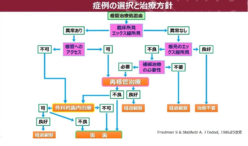 根管治療の症例選択と治療方針を決定するフローチャート(診断基準の図解)