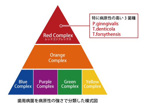 ソクリャンスキーの有名な歯周病菌のピラミッ