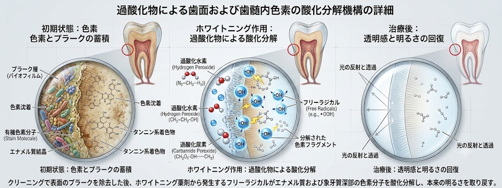 過酸化水素によるホワイトニングの作用で歯の色素が分解され明るさが回復する仕組みを説明した図