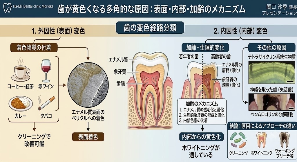 歯の黄ばみの原因とホワイトニングが適している変色を説明した図