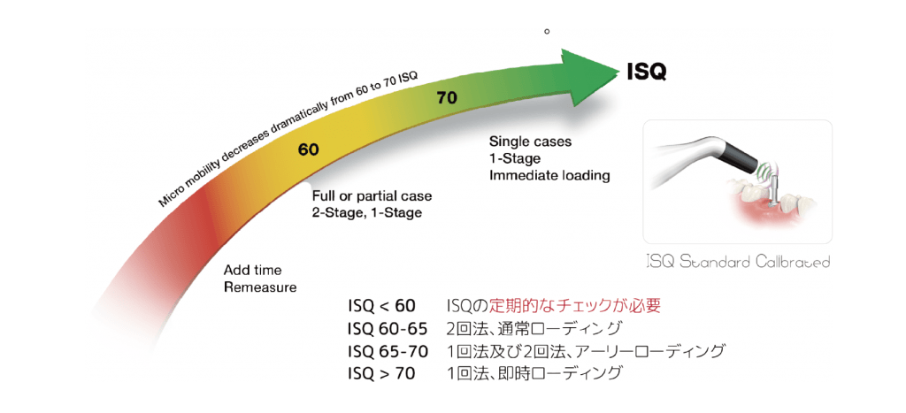 ISPチェッカー