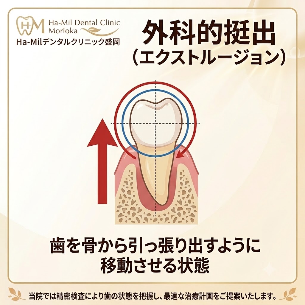 エクスとルージョン