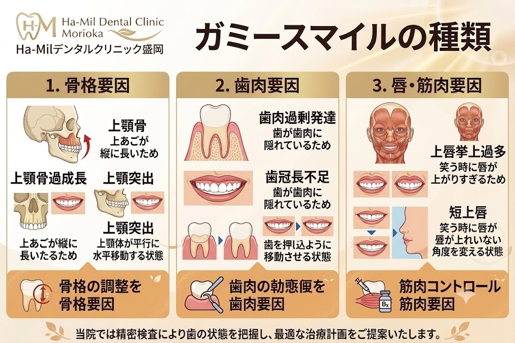 ガミースマイルの種類と治療方法