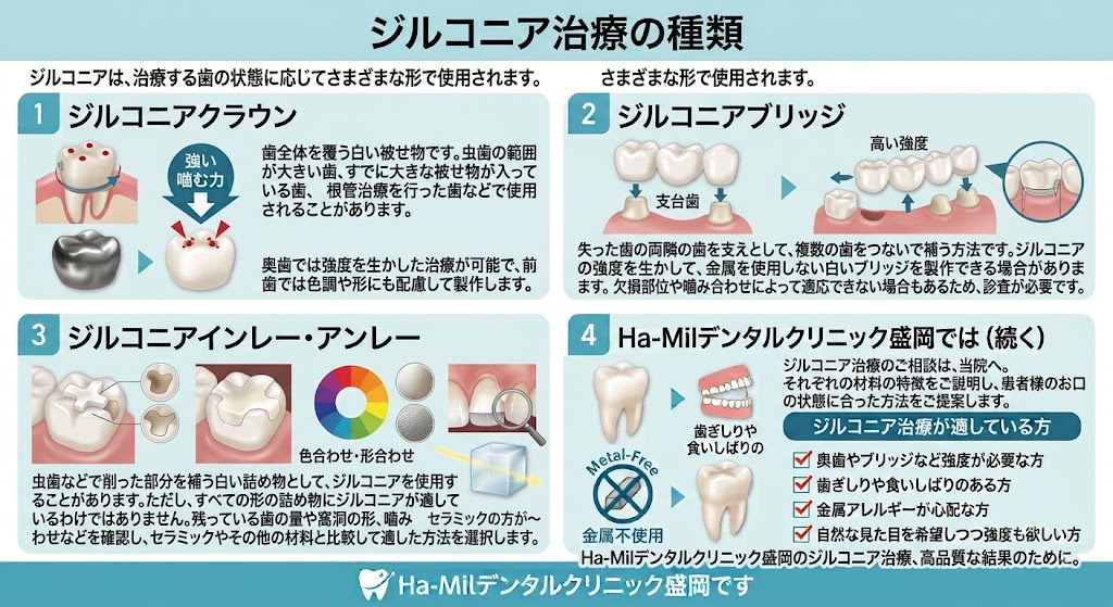 ジルコニアの種類