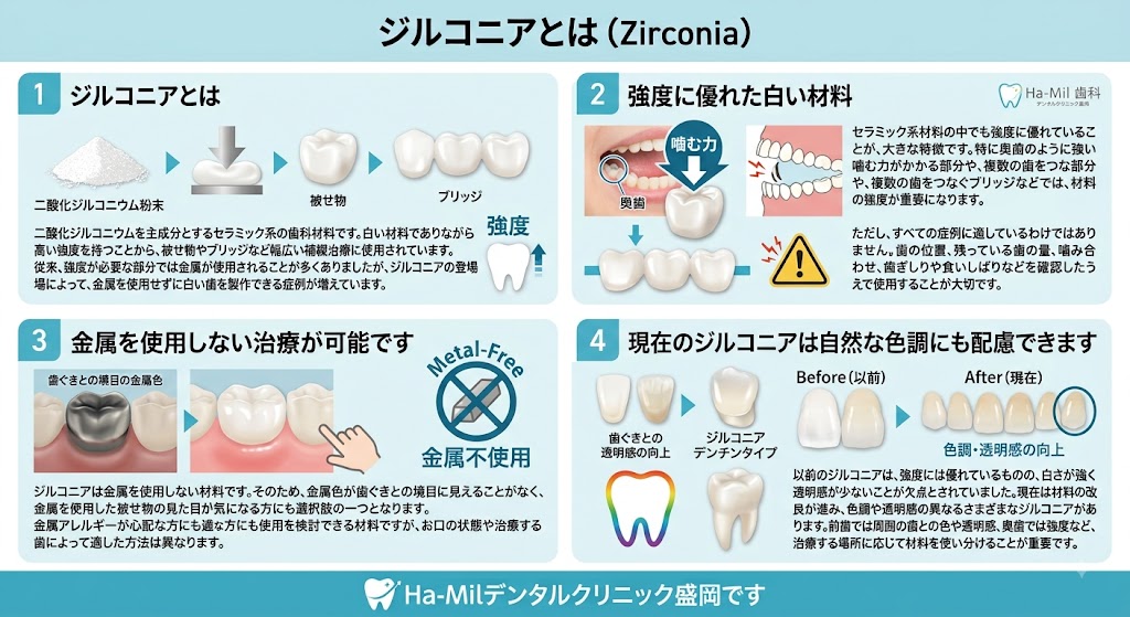 ジルコニアとは